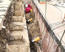 除去式マルチストランドアンカー